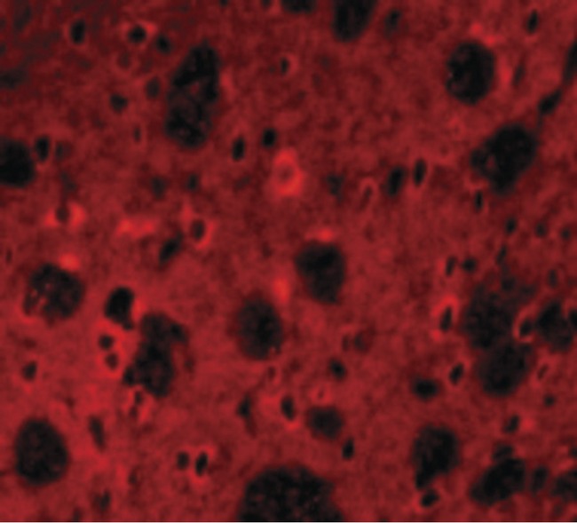APP / Beta Amyloid Precursor Antibody - Immunofluorescence of APP in Rat Brain cells with APP antibody at 20 ug/ml.