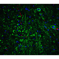 APP / Beta Amyloid Precursor Antibody - Immunofluorescence of APP in mouse brain tissue with APP Antibodyat 20 µg/mL. Green: APP antibody  Red: Phylloidin staining Blue: DAPI staining