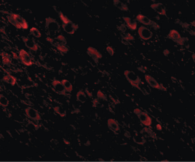 APP / Beta Amyloid Precursor Antibody - Immunofluorescence of APP in mouse brain tissue with APP antibody at 20 ug/ml.