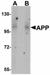 APP / Beta Amyloid Precursor Antibody - Western blot of APP in mouse brain tissue lysate with APP antibody at (A) 1 and (B) 2 ug/ml. Below: Immunohistochemistry of APP in mouse brain tissue with APP antibody at 2.5 ug/ml.