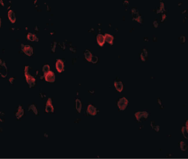 APP / Beta Amyloid Precursor Antibody - Immunofluorescence of APP in mouse brain tissue with APP antibody at 20 ug/ml.