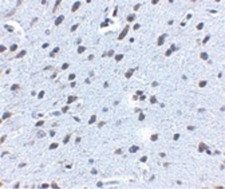 APP / Beta Amyloid Precursor Antibody - Immunohistochemistry of APP in mouse brain tissue with APP antibody at 2.5 ug/ml.