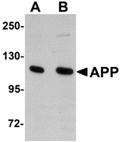 APP / Beta Amyloid Precursor Antibody - Western blot of APP in rat brain tissue lysate with APP antibody at (A) 1 and (B) 2 ug/ml. Below: Immunohistochemistry of APP in mouse brain tissue with APP antibody at 2.5 ug/ml.