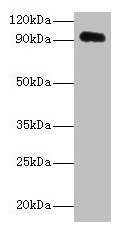 APP / Beta Amyloid Precursor Antibody - Western blot All lanes: Amyloid beta A4 protein antibody at 2µg/ml Lane 1: HL60 whole cell lysate Secondary Goat polyclonal to rabbit IgG at 1/10000 dilution Predicted band size: 87, 35, 77, 79, 81, 83, 85, 86, 73, 84 kDa Observed band size: 95 kDa