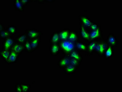 APP / Beta Amyloid Precursor Antibody - Immunofluorescence staining of Hela cells with Rabbit anti-human Amyloid beta A4 protein Apolyclonal Antibody at 1:133, counter-stained with DAPI. The cells were fixed in 4% formaldehyde, permeabilized using 0.2% Triton X-100 and blocked in 10% normal Goat Serum. The cells were then incubated with the antibody overnight at 4°C. The secondary antibody was Alexa Fluor 488-congugated AffiniPure Goat Anti-Rabbit IgG(H+L).
