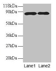 APP / Beta Amyloid Precursor Antibody - Western blot All lanes: Amyloid beta A4 protein antibody at 2µg/ml Lane 1: HL60 whole cell lysate Lane 2: Mouse kidney tissue Secondary Goat polyclonal to rabbit IgG at 1/10000 dilution Predicted band size: 87, 35, 77, 79, 81, 83, 85, 86, 73, 84 kDa Observed band size: 87 kDa