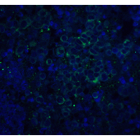 APP / Beta Amyloid Precursor Antibody - Immunofluorescence of ASAH1 in rat heart tissue with ASAH1 antibody at 20 µg/mL.Green: APP Antibody  Blue: DAPI staining