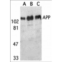 APP / Beta Amyloid Precursor Antibody - Western blot analysis of APP in (A) human, (B) mouse, and (C) rat brain tissue lysates with APP antibody at 1 µg/mL.