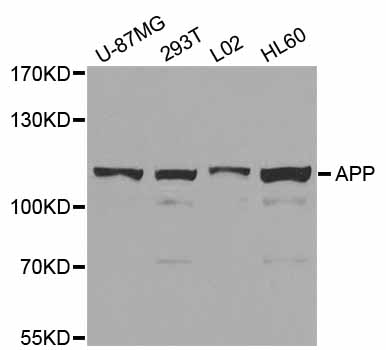 APP / Beta Amyloid Precursor Antibody - Western blot analysis of extracts of various cell lines, using APP antibody at 1:1000 dilution. The secondary antibody used was an HRP Goat Anti-Rabbit IgG (H+L) at 1:10000 dilution. Lysates were loaded 25ug per lane and 3% nonfat dry milk in TBST was used for blocking. An ECL Kit was used for detection and the exposure time was 10s.