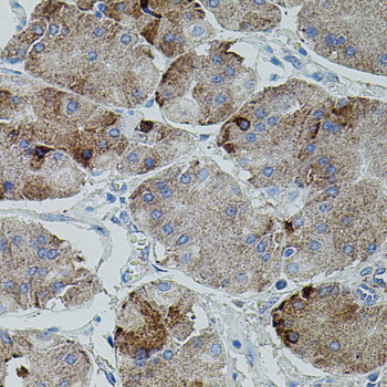 APP / Beta Amyloid Precursor Antibody - Immunohistochemistry of paraffin-embedded human stomach using APP antibodyat dilution of 1:100 (40x lens).