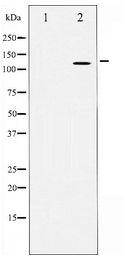 APP / Beta Amyloid Precursor Antibody - Western blot of Amyloid beta A4 expression in HeLa whole cell lysates,The lane on the left is treated with the antigen-specific peptide.