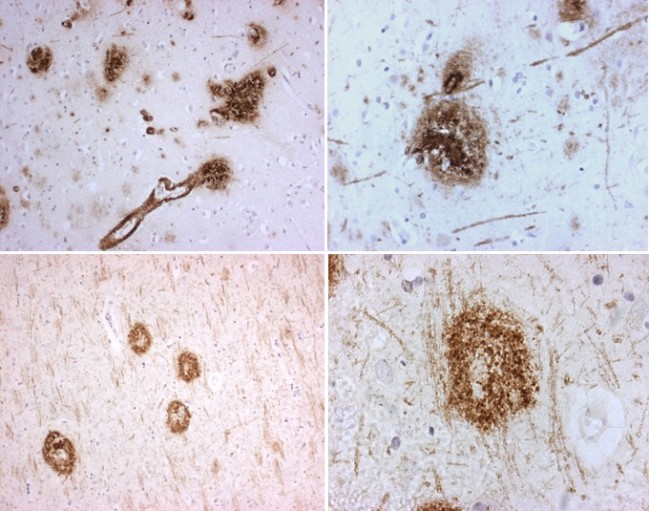 APP / Beta Amyloid Precursor Antibody - Amyloid-beta (N-term), Human, mAb VU17