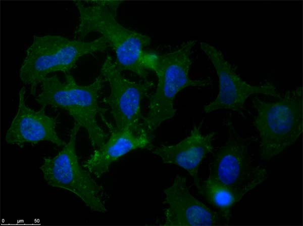 APP / Beta Amyloid Precursor Antibody - Immunofluorescence microscopy of rabbit Anti-Beta Amyloid antibody using HeLa cells fixed with MeOH. Anti-Beta Amyloid Antibody was used at 1 µg/mL, O/N at 4°C. Secondary antibody: Anti-RABBIT IgG DyLight 488 Conjugated Preadsorbed at 2 ug/ml for 1 h at RT. Localization: APP is a cell surface protein that rapidly becomes internalized to endosomes and lysosomes. Some APP accumulates in secretory transport vesicles. Colocalizes with other proteins in a vesicular pattern in cytoplasm and perinuclear regions. Staining: Amyloid beta as green fluorescent signal with DAPI (blue) nuclear counterstain.