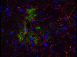 APP / Beta Amyloid Precursor Antibody - Immunohistochemistical detection of beta Amyloid using Anti-Beta Amyloid Antibody on TG APP23 mouse brain cortex frozen sections. Anti-Beta Amyloid Antibody used at 1/200 and incubated for 2 hours in TBS/BSA/Tween/azide. Fluorescent labeled anti rabbit IgG was then added.
