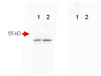 APP / Beta Amyloid Precursor Antibody - Mouse Brain (Lane 1) and Mouse Spinal Chord (Lane 2) were run on a 4-20% gradient gel, Blocked in 1% BSA-TBS-T 30 min RT and probed with Rb-a-Beta Amyloid 1:1000 in 1% BSA-TBS-T o/n 4°C. HRP Gt-a-Rb 611-103-122 Lot#21231 1:40,000 in MB-070 30 min RT. FEMTOMAX chemiluminescent substrate was used for detection of a 40-50 kD band consistent with a higher MW precursor form of beta amyloid. A secondary Ab only control (Shown right) showed no detectable signal.