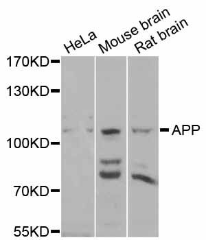 APP / Beta Amyloid Precursor Antibody - Western blot analysis of extracts of various cell lines, using APP antibody at 1:1000 dilution. The secondary antibody used was an HRP Goat Anti-Rabbit IgG (H+L) at 1:10000 dilution. Lysates were loaded 25ug per lane and 3% nonfat dry milk in TBST was used for blocking. An ECL Kit was used for detection and the exposure time was 90s.