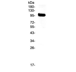 APP / Beta Amyloid Precursor Antibody - Western blot testing of human T-47D cell lysate with APP antibody at 0.5ug/ml. Expected molecular weight 79~120 kDa depending on glycosylation level.