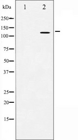 APP / Beta Amyloid Precursor Antibody - Western blot analysis of Amyloid beta A4 expression in HeLa whole cells lysates. The lane on the left is treated with the antigen-specific peptide.