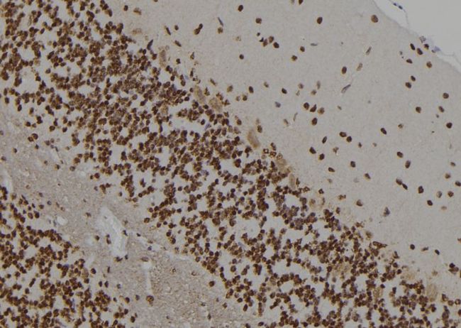 APP / Beta Amyloid Precursor Antibody - 1:100 staining rat brain tissue by IHC-P. The sample was formaldehyde fixed and a heat mediated antigen retrieval step in citrate buffer was performed. The sample was then blocked and incubated with the antibody for 1.5 hours at 22°C. An HRP conjugated goat anti-rabbit antibody was used as the secondary.