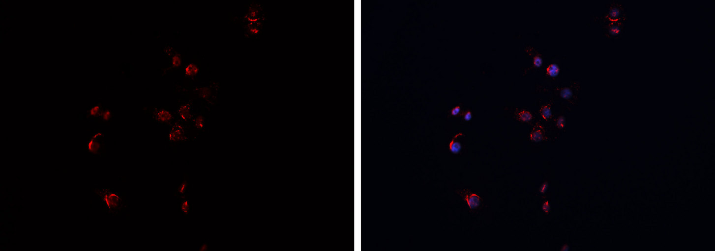 APP / Beta Amyloid Precursor Antibody - Staining HeLa cells by IF/ICC. The samples were fixed with PFA and permeabilized in 0.1% Triton X-100, then blocked in 10% serum for 45 min at 25°C. The primary antibody was diluted at 1:200 and incubated with the sample for 1 hour at 37°C. An Alexa Fluor 594 conjugated goat anti-rabbit IgG (H+L) Ab, diluted at 1/600, was used as the secondary antibody.