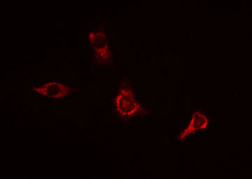 APP / Beta Amyloid Precursor Antibody