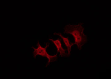 APP / Beta Amyloid Precursor Antibody