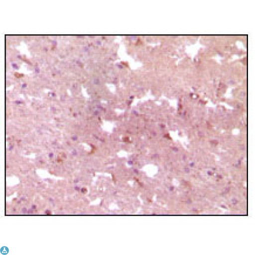 APP / Beta Amyloid Precursor Antibody - Immunohistochemistry (IHC) analysis of paraffin-embedded human Alzheimer brain tissue, showing cytoplasmic localization with DAB staining using APP Monoclonal Antibody.