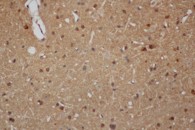 APP / Beta Amyloid Precursor Antibody - Immunohistochemistry of paraffin-embedded Mouse brain using AB42 Polyclonal Antibody at dilution of 1:50.