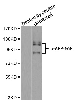 APP / Beta Amyloid Precursor Antibody - Western blot analysis of extracts from mouse brain tissue.