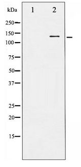 APP / Beta Amyloid Precursor Antibody - Western blot of Amyloid beta A4 phosphorylation expression in HeLa whole cell lysates,The lane on the left is treated with the antigen-specific peptide.