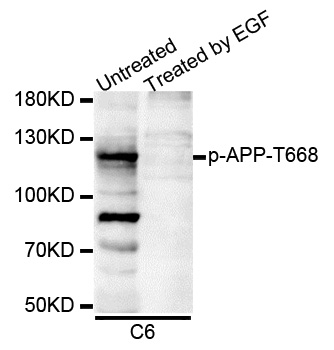 APP / Beta Amyloid Precursor Antibody - Western blot analysis of extracts of C6 cells.
