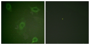 APP / Beta Amyloid Precursor Antibody - Immunofluorescence of HeLa cells, using Amyloid beta A4 (Phospho-Thr743/668) Antibody. The sample on the right was incubated with synthetic peptide.