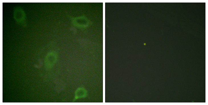 APP / Beta Amyloid Precursor Antibody - Immunofluorescence analysis of HeLa cells, using Amyloid beta A4 (Phospho-Thr743/668) Antibody. The picture on the right is blocked with the phospho peptide.