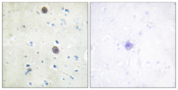 APP / Beta Amyloid Precursor Antibody - Immunohistochemistry analysis of paraffin-embedded human brain, using Amyloid beta A4 (Phospho-Thr743/668) Antibody. The picture on the right is blocked with the phospho peptide.
