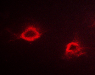 APP / Beta Amyloid Precursor Antibody - Staining HeLa cells by IF/ICC. The samples were fixed with PFA and permeabilized in 0.1% saponin prior to blocking in 10% serum for 45 min at 37°C. The primary antibody was diluted 1/400 and incubated with the sample for 1 hour at 37°C. A Alexa Fluor® 594 conjugated goat polyclonal to rabbit IgG (H+L), diluted 1/600 was used as secondary antibody.