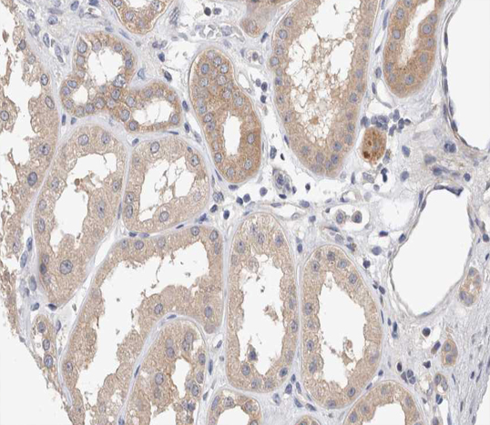 APP / Beta Amyloid Precursor Antibody - 1:200 staining human kidney tissue by IHC-P. The tissue was formaldehyde fixed and a heat mediated antigen retrieval step in citrate buffer was performed. The tissue was then blocked and incubated with the antibody for 1.5 hours at 22°C. An HRP conjugated goat anti-rabbit antibody was used as the secondary.