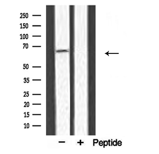 APPBP2 Antibody - Western blot analysis of extracts of various tissue sample using VEGFR2 antibody.