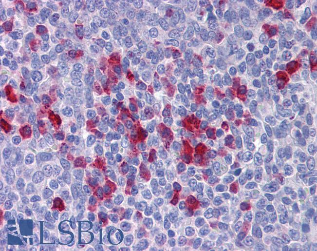 APPL1 / APPL Antibody - Anti-APPL1 antibody IHC of human tonsil. Immunohistochemistry of formalin-fixed, paraffin-embedded tissue after heat-induced antigen retrieval. Antibody concentration 5 ug/ml.  This image was taken for the unconjugated form of this product. Other forms have not been tested.