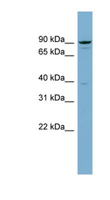 APPL1 / APPL Antibody - APPL1 antibody Western blot of THP-1 cell lysate. This image was taken for the unconjugated form of this product. Other forms have not been tested.