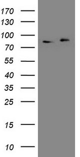 APPL1 / APPL Antibody - HEK293T cells were transfected with the pCMV6-ENTRY control. (Left lane) or pCMV6-ENTRY APPL1. (Right lane) cDNA for 48 hrs and lysed. Equivalent amounts of cell lysates. (5 ug per lane) were separated by SDS-PAGE and immunoblotted with anti-APPL1. (1:2000)