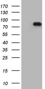 APPL1 / APPL Antibody - HEK293T cells were transfected with the pCMV6-ENTRY control. (Left lane) or pCMV6-ENTRY APPL1. (Right lane) cDNA for 48 hrs and lysed. Equivalent amounts of cell lysates. (5 ug per lane) were separated by SDS-PAGE and immunoblotted with anti-APPL1. (1:500)