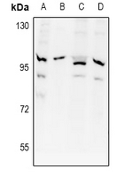 APPL1 / APPL Antibody - Western blot analysis of APPL1 expression in SP20 (A), A2780 (B), SKOVCAR3 (C), PC12 (D) whole cell lysates.