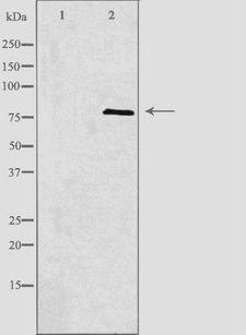 APPL1 / APPL Antibody - Western blot analysis of extracts of A549 cells using APPL1 antibody. The lane on the left is treated with the antigen-specific peptide.
