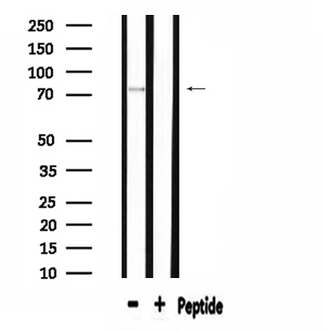 APPL1 / APPL Antibody - Western blot analysis of extracts of 293 cells using APPL1 antibody.