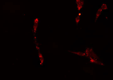 APPL1 / APPL Antibody - Staining A549 cells by IF/ICC. The samples were fixed with PFA and permeabilized in 0.1% Triton X-100, then blocked in 10% serum for 45 min at 25°C. The primary antibody was diluted at 1:200 and incubated with the sample for 1 hour at 37°C. An Alexa Fluor 594 conjugated goat anti-rabbit IgG (H+L) antibody, diluted at 1/600, was used as secondary antibody.