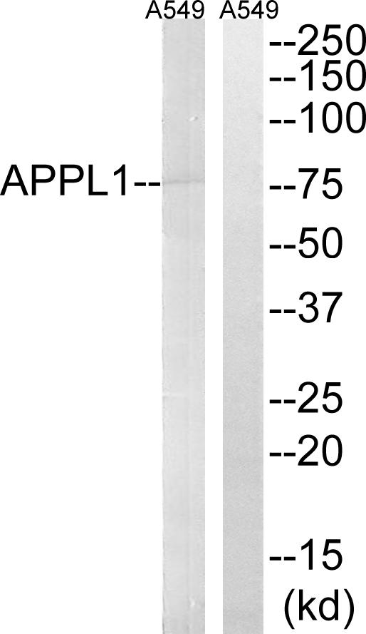 APPL1 / APPL Antibody - Western blot analysis of extracts from A549 cells, using APPL1 antibody.