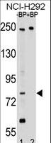 APPL2 Antibody - Western blot of APPL2 Antibody antibody pre-incubated without(lane 1) and with(lane 2) blocking peptide in NCI-H292 cell line lysate. APPL2 Antibody (arrow) was detected using the purified antibody.