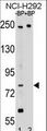 APPL2 Antibody - Western blot of APPL2 Antibody antibody pre-incubated without(lane 1) and with(lane 2) blocking peptide in NCI-H292 cell line lysate. APPL2 Antibody (arrow) was detected using the purified antibody.