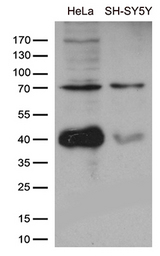 APPL2 Antibody - Western blot analysis of extracts. (35ug) from cell lines and/or tissue lysates by using anti-APPL2 monoclonal antibody. (1:500)