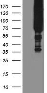 APPL2 Antibody - HEK293T cells were transfected with the pCMV6-ENTRY control. (Left lane) or pCMV6-ENTRY APPL2. (Right lane) cDNA for 48 hrs and lysed